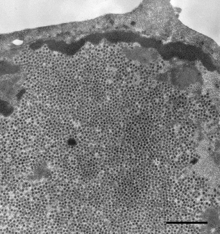 Humane Papillomviren (HPV) unter dem Elektronenmikroskop.  Quelle: Hans R. Gelderblom/ RKI